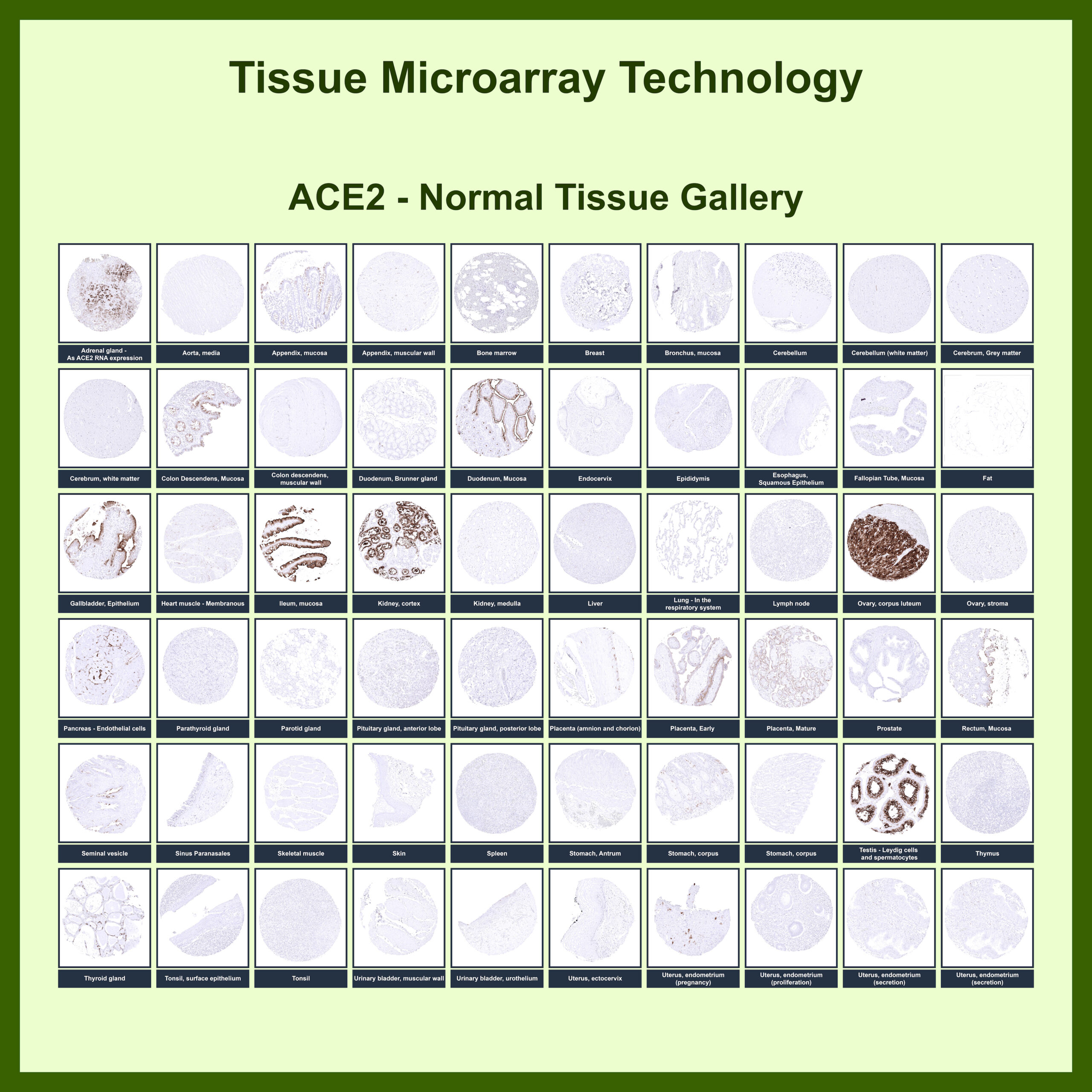ACE-2 Antibody (ACE2/6788R)