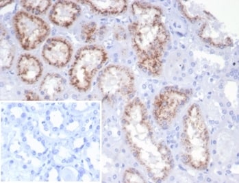 RBP4/Retinol-Binding Protein 4 Antibody (rRBP4/7372)