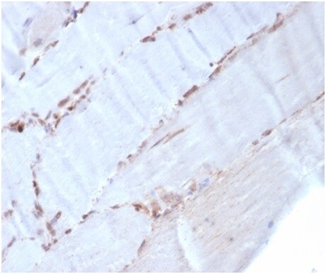 alpha-Smooth Muscle Actin Antibody (rACTA2/1625)
