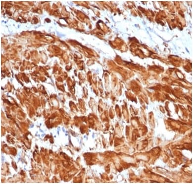 alpha-Smooth Muscle Actin Antibody (rACTA2/1625)
