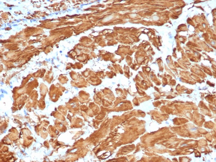 alpha-Smooth Muscle Actin Antibody (ACTA2/1614R)