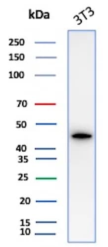 alpha-Smooth Muscle Actin Antibody (ACTA2/1614R)