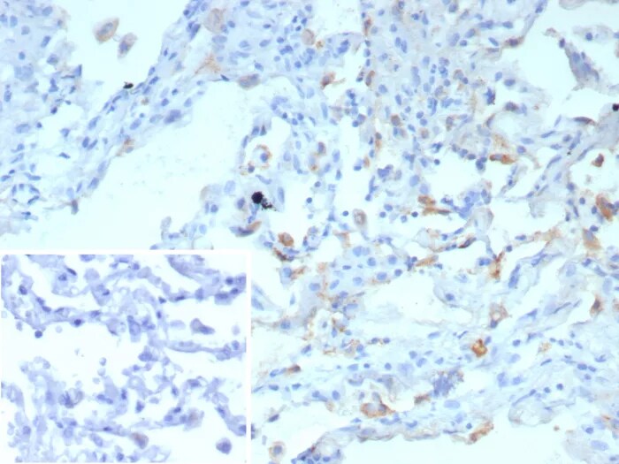 SP-D Antibody (rSFTPD/8065)