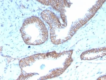 SHBG Antibody (rSHBG/245)