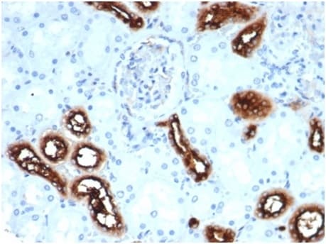 Fascin Antibody (rFSCN1/6464)