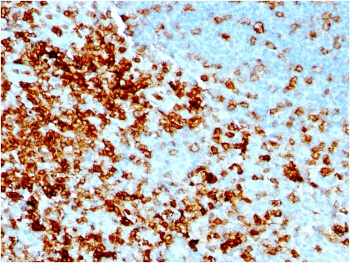 CD43/Sialophorin Antibody (rSPN/1094)