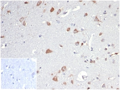 Osteopontin/OPN Antibody (OSP/4589)