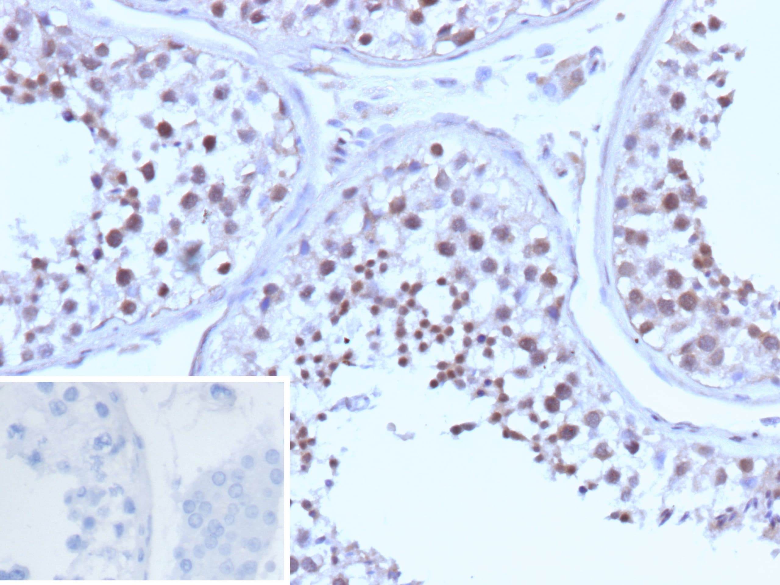 BRCA1 Antibody (BRCA1/13502R)
