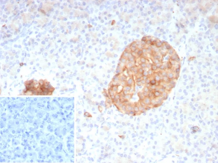Synaptophysin Antibody (rSYP/8807)