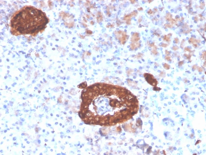 Synaptophysin Antibody (rSYP/4654)