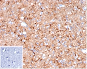 Synaptophysin Antibody (rSYP/6856)