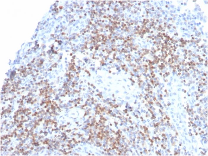 ZAP70 Antibody (ZAP70/3921R)