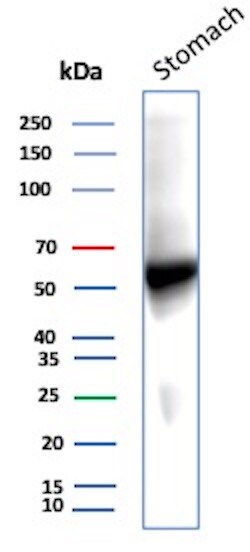 Carbonic Anhydrase IX/CA9 Antibody (CA9/9621R)