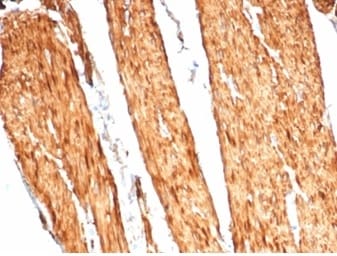 Caldesmon/CALD1 Antibody (CALD1/7024R)