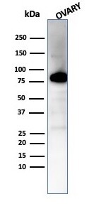 Caldesmon/CALD1 Antibody (CALD1/7024R)