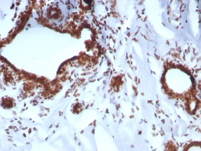 BAP1 Antibody (BAP1/8959R)