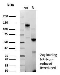 BAP1 Antibody (BAP1/9120R)