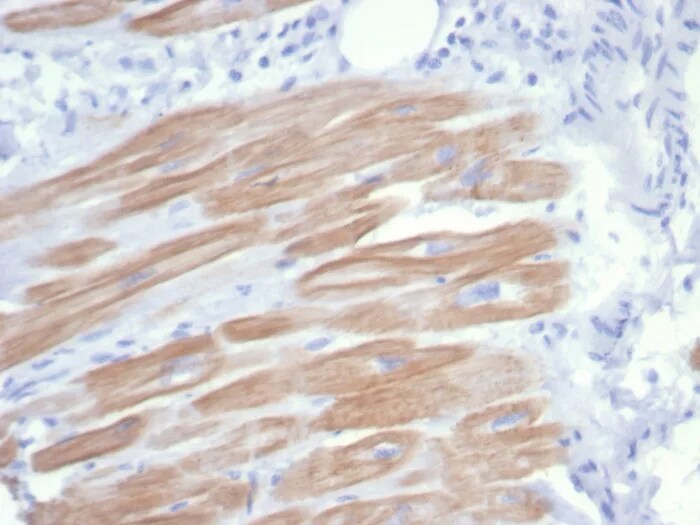 Alpha Actinin 2 Antibody (rACTN2/7361)