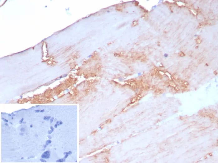 Alpha Actinin 2 Antibody (rACTN2/8177)