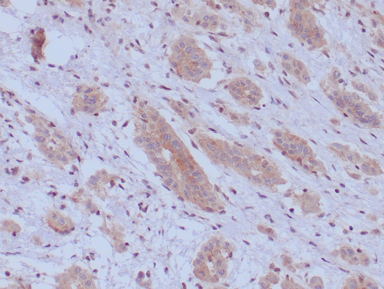BAP1 Antibody (BAP1/9795R)