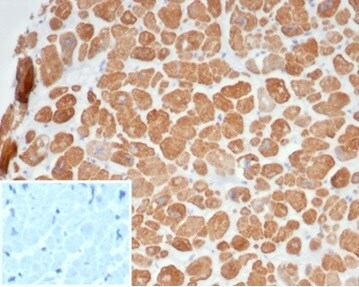 Alpha Actinin 2 Antibody (ACTN2/7040R)