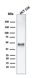 Cyclin E1 Antibody (rCCNE1/4936)