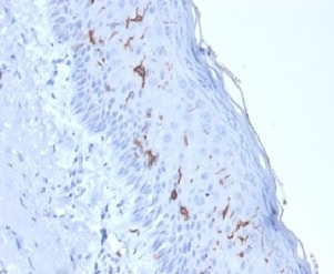 CD1a Antibody (rC1A/711)