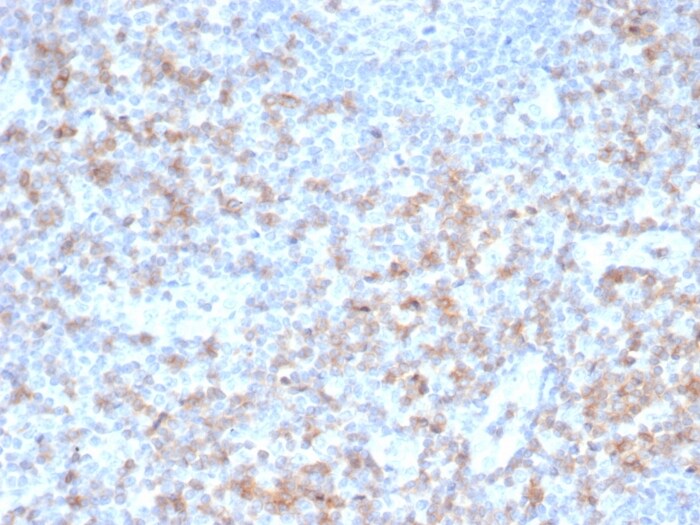 CD5 Antibody (rC5/6462)