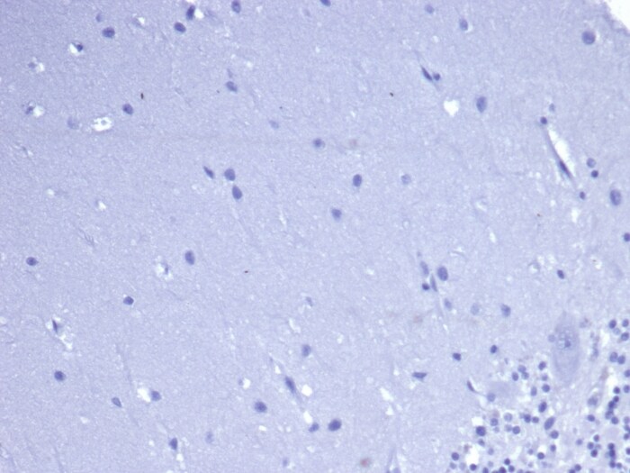 CD5 Antibody (rC5/6462)
