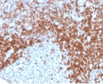 CD5 Antibody (rC5/6429)