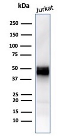CD5 Antibody (rC5/6429)