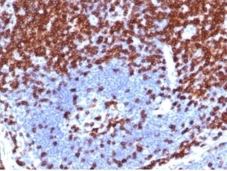 CD5 Antibody (C5/4561R)