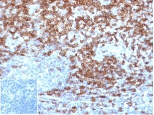 CD5 Antibody (C5/4561R)