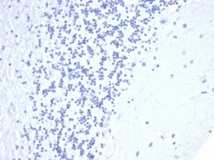 CD5 Antibody (C5/4561R)