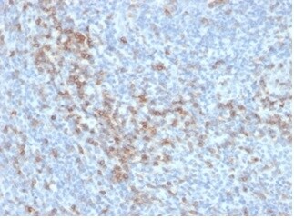 CD5 Antibody (C5/6438R)
