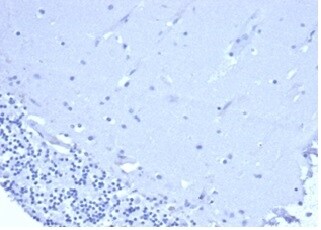 CD5 Antibody (C5/6438R)