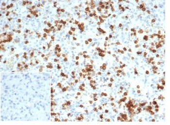 CD6 Antibody (C6/7022R)