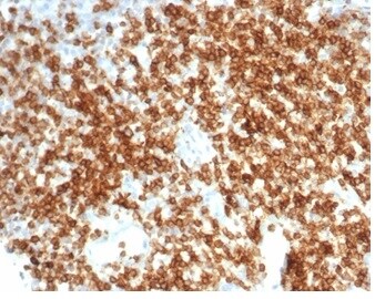 CD6 Antibody (C6/7022R)