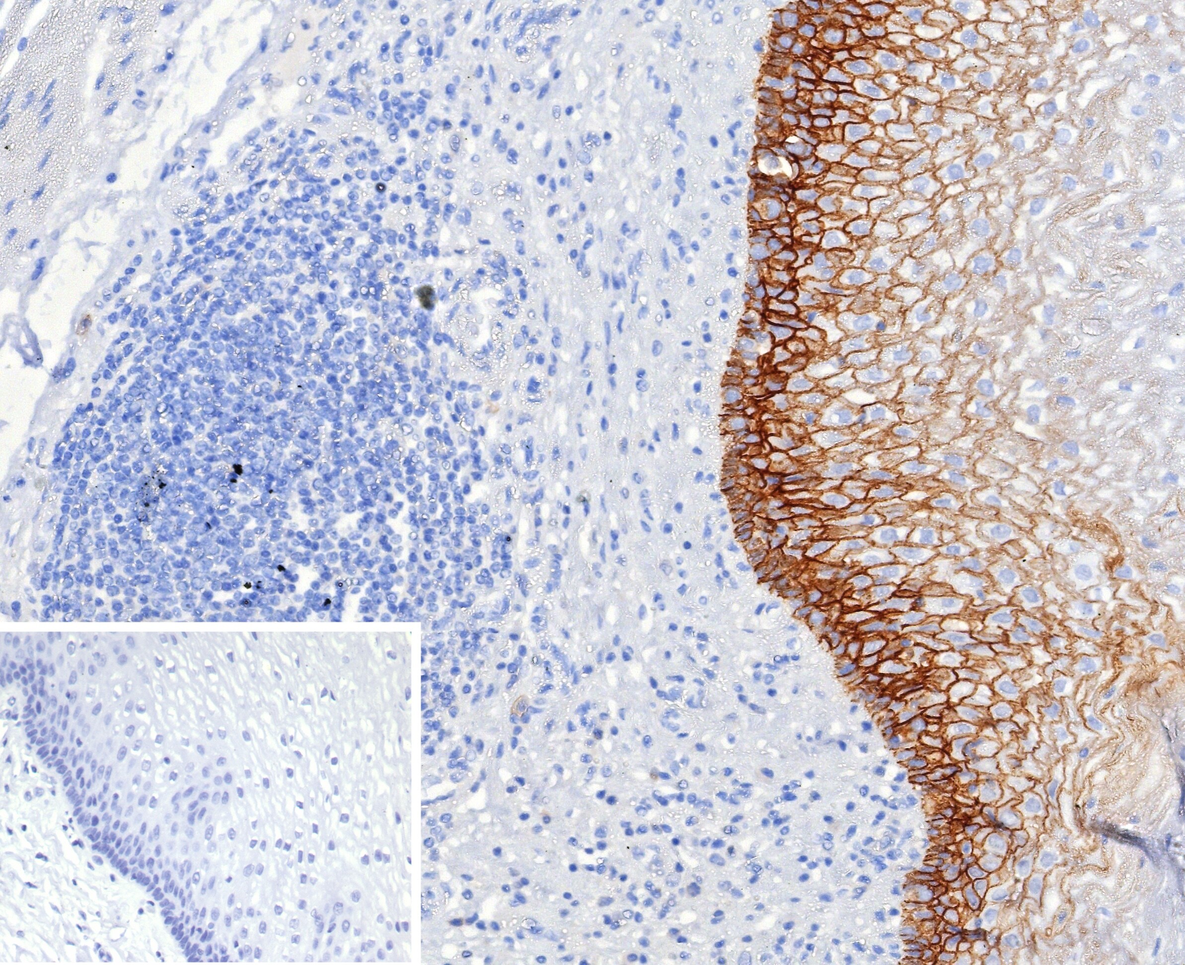 CD44, variant 6 Antibody (CD44V6/2496)