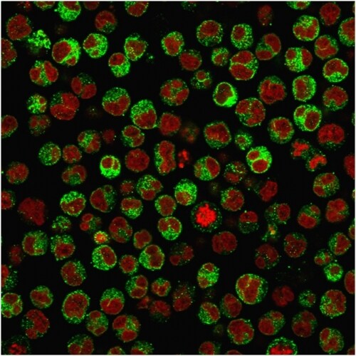 CD79A Antibody (rIGA/764)