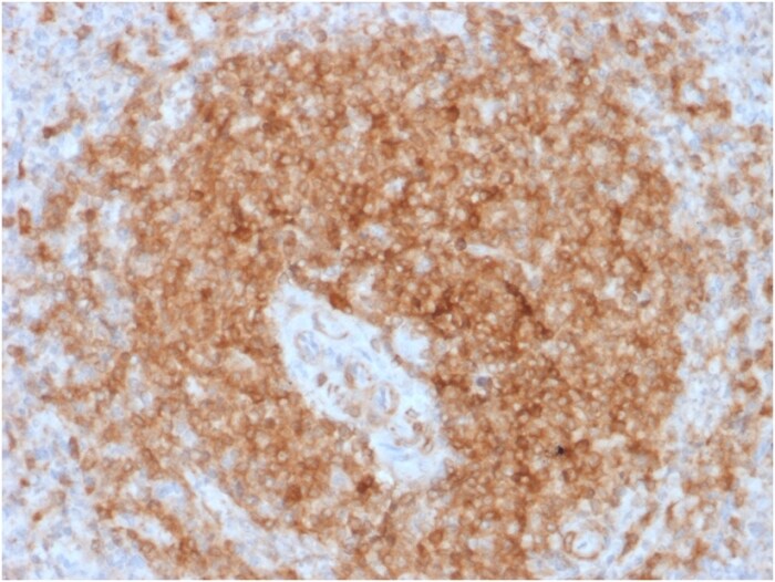 CD79A Antibody (rIGA/764)