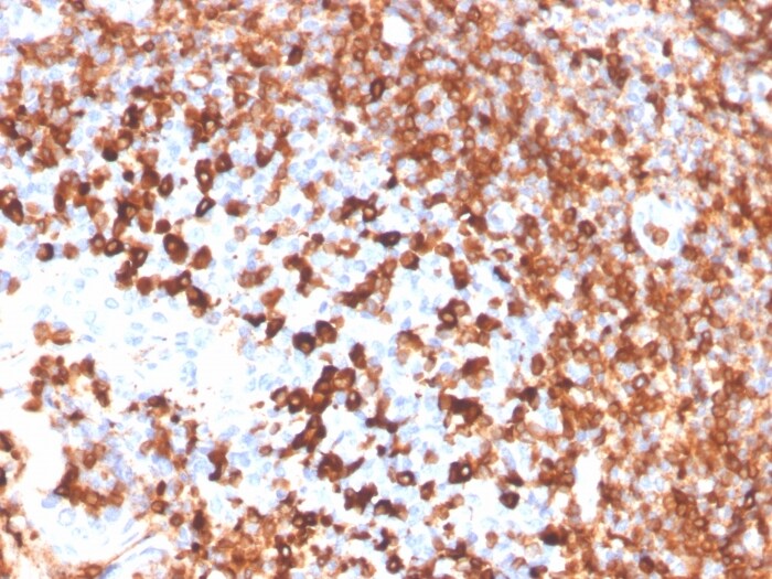 CD79A Antibody (IGA/3939R)