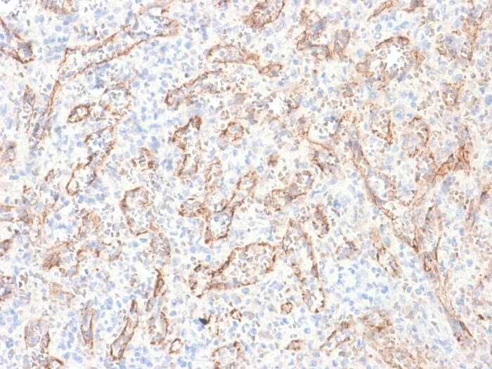 TL1A/TNFSF15 Antibody (rVEGI/1283)