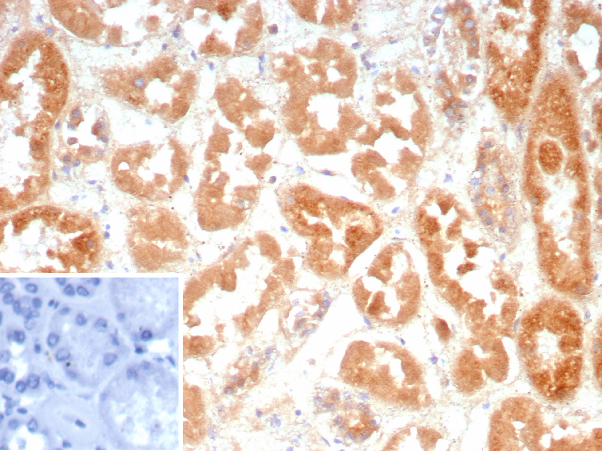 Cadherin-6/KCAD Antibody (CDH6/9300R)
