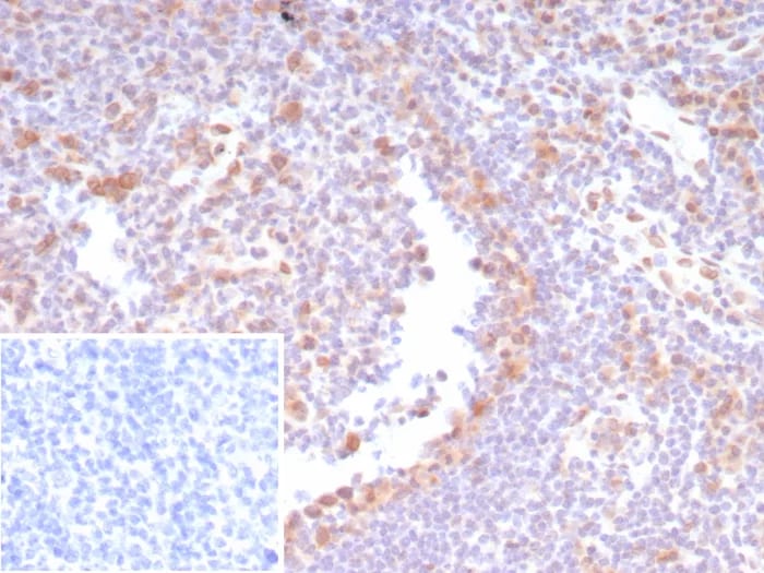 CDK4 Antibody (CDK4/8210R)