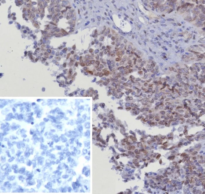 CDK4 Antibody (CDK4/8351R)