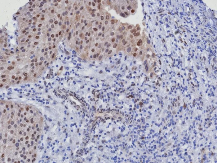 CDK4 Antibody (CDK4/8351R)