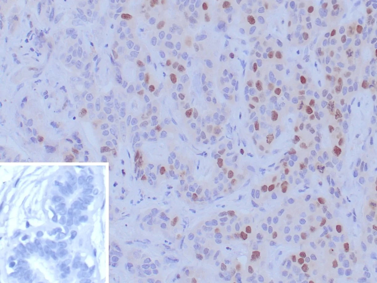 BRCA1 Antibody (BRCA1/9797R)