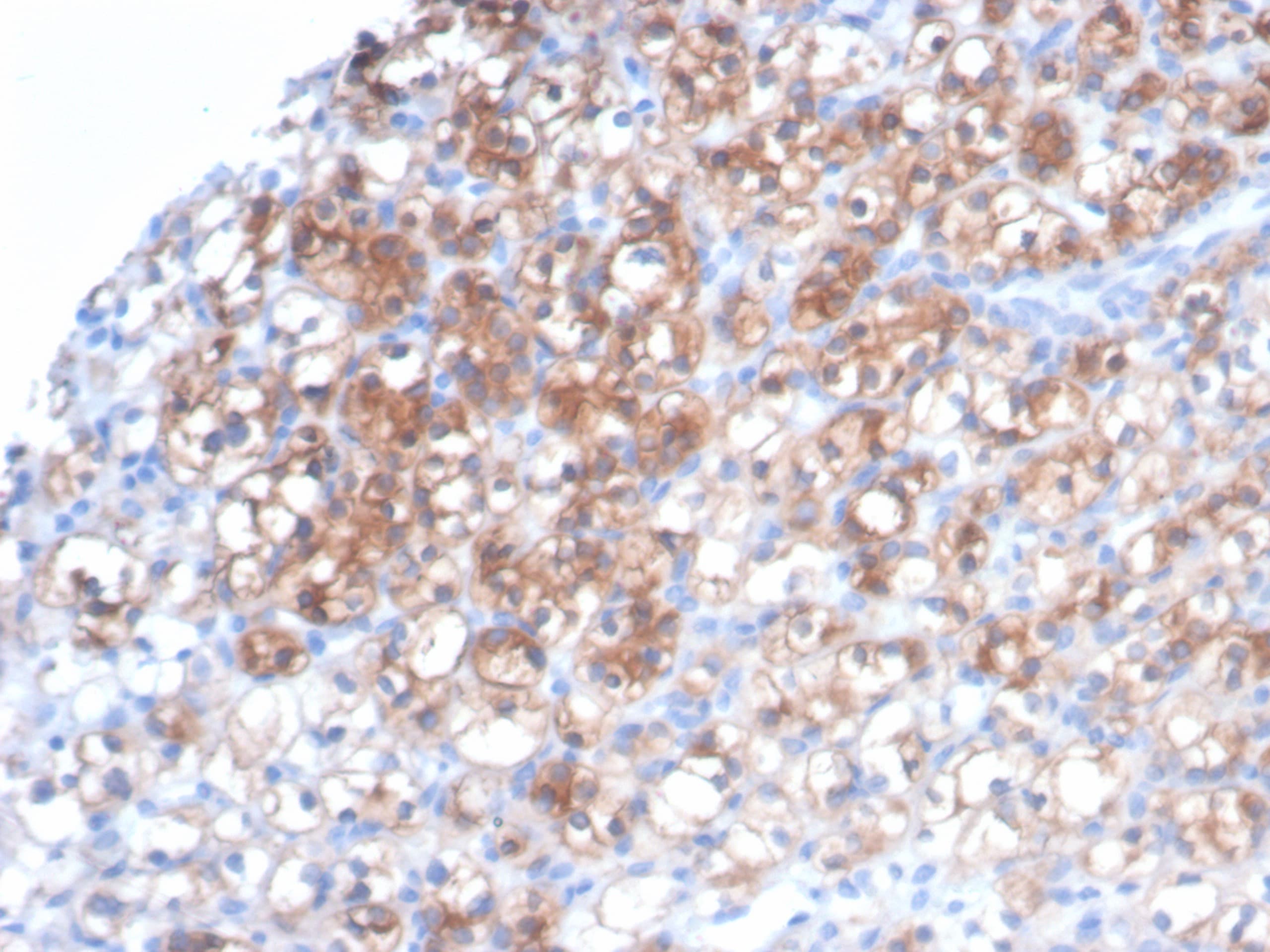 HSP27 Antibody (HSPB1/7038R)