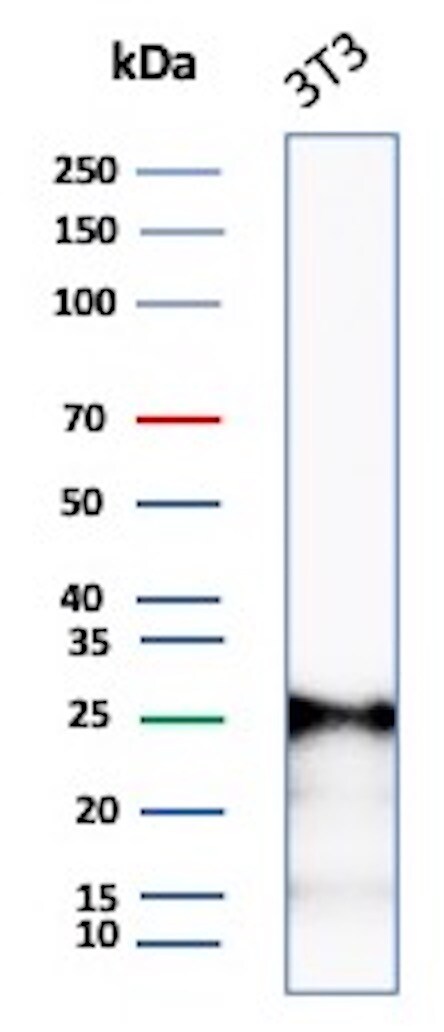 p27/Kip1 Antibody (rKIP1/1356)